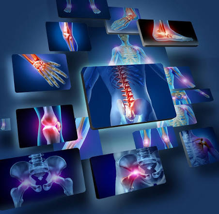 Pain Management
